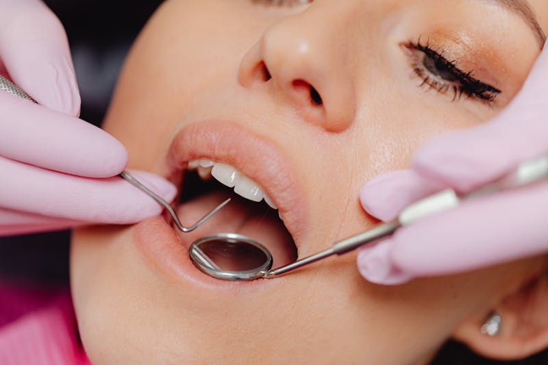 Gum health assessments